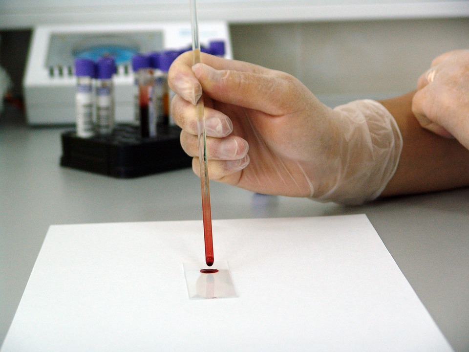 Leobener Wissenschaftler bringen innovative Materialien zur ISS